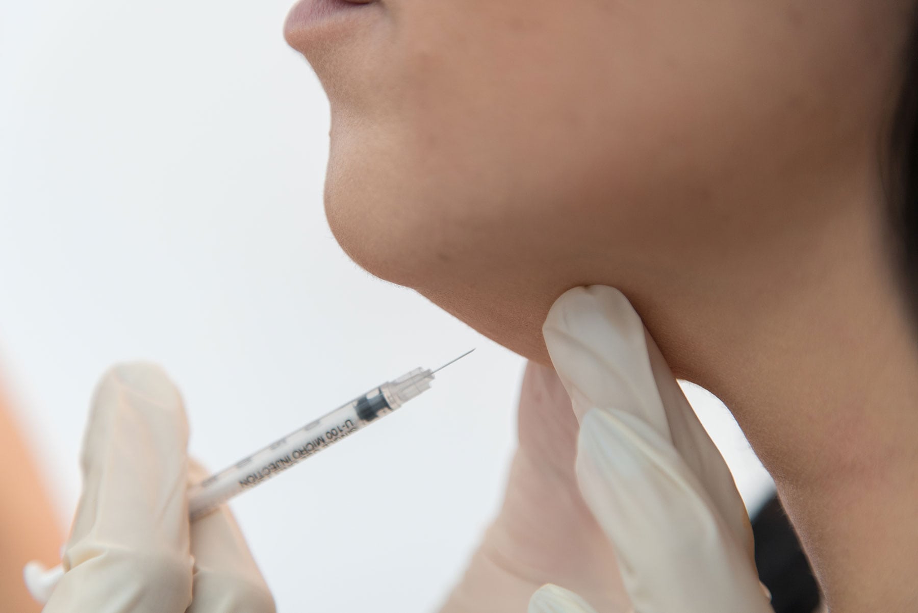 Chin Enhancement Treatment