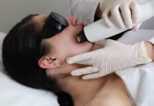Cheek Enhancement