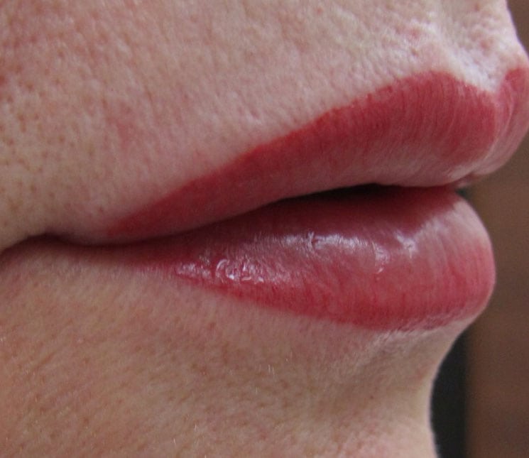 Lip Blush Treatment