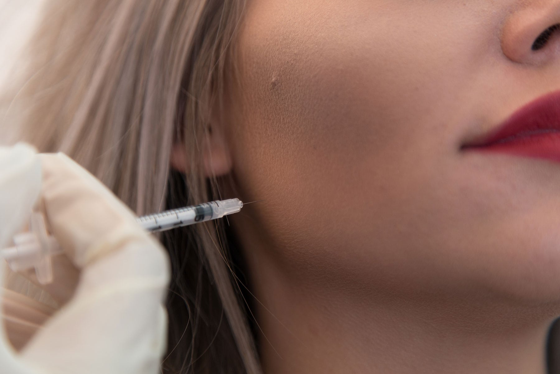 Jaw Reduction Treatment London