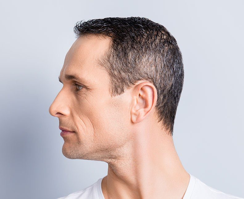 What can jawline fillers do for you? The London Cosmetic Clinic