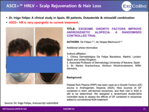Пример лечения выпадения волос Asce