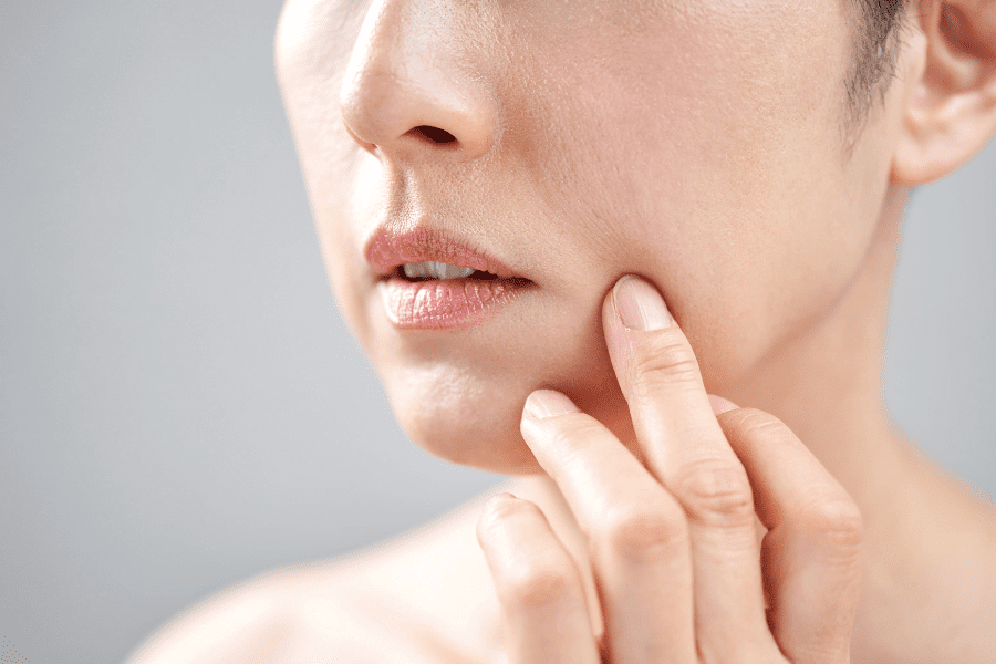 Vampire Facial Benefits