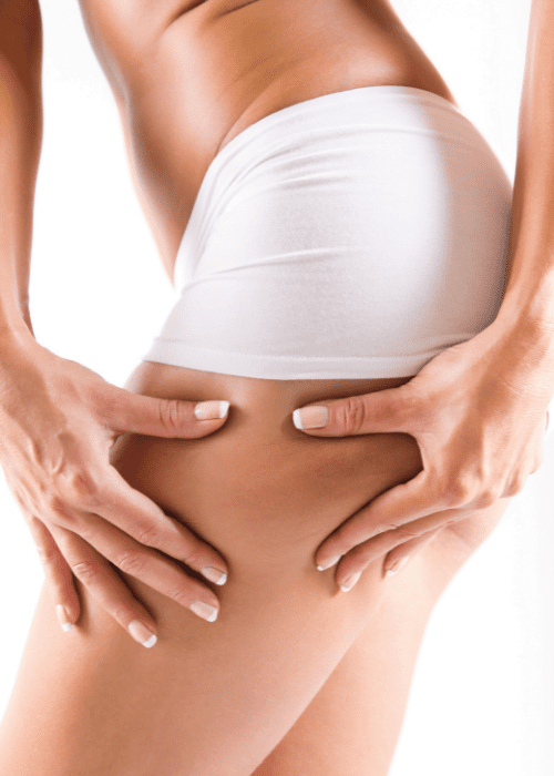 Cellulite Treatment in Lonodn