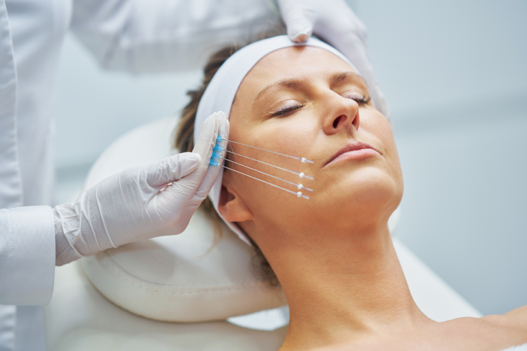 FaceTite: London Surgical-Look Lift Without the Knife