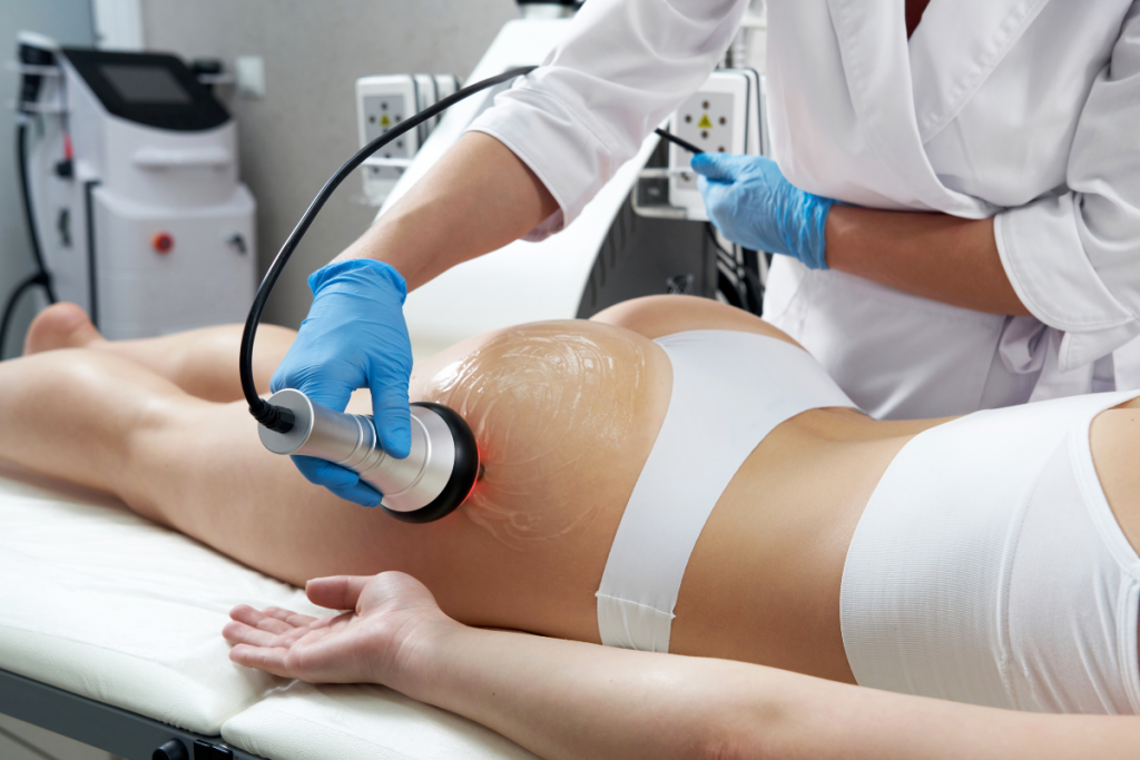 Body Contouring: Achieving Your Summer Body Goals Without Surgery