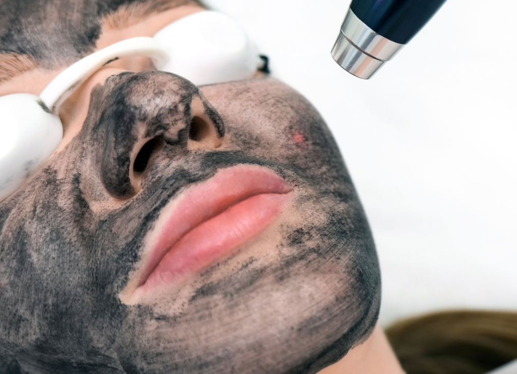 Chemical Peels: Your Complete Guide to Skin Renewal in London