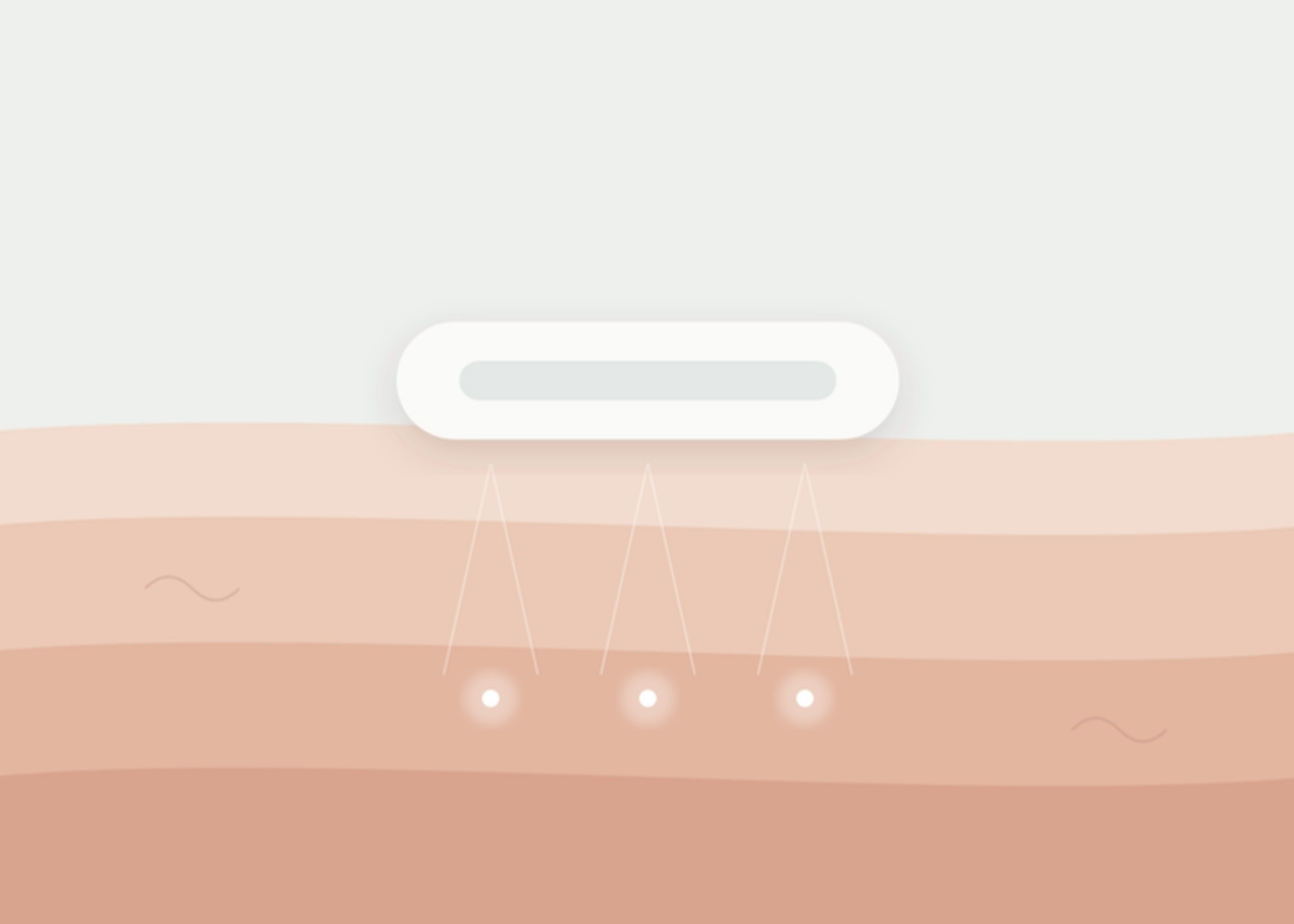 What Is Ultherapy? Results, Cost and Recovery in London